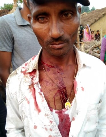 Leopard attacked farmer in Farm Tanda, injured