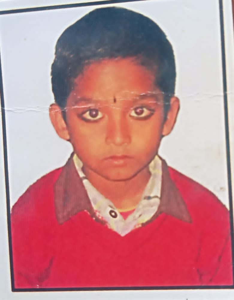 Stray dogs attacked two children, one died, angry villagers blocked the road by placing dead bodies
