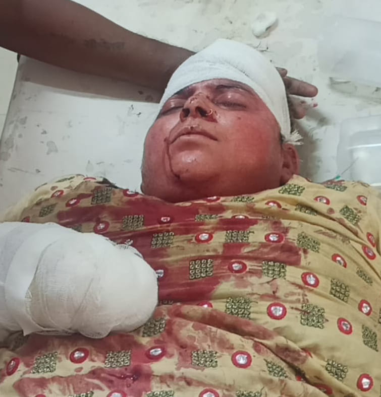 crime,accident,kannauj,kannauj news