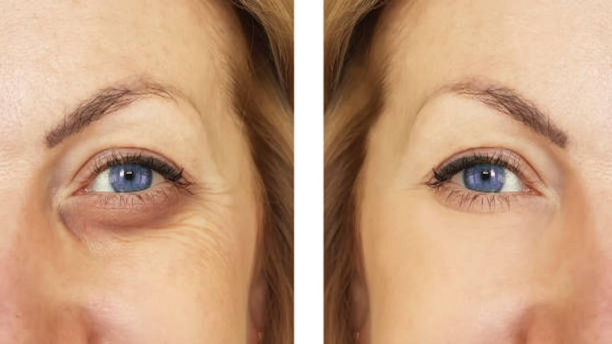 want to get rid of puffy eyes use these things loves katrina kaif alia bhatt
