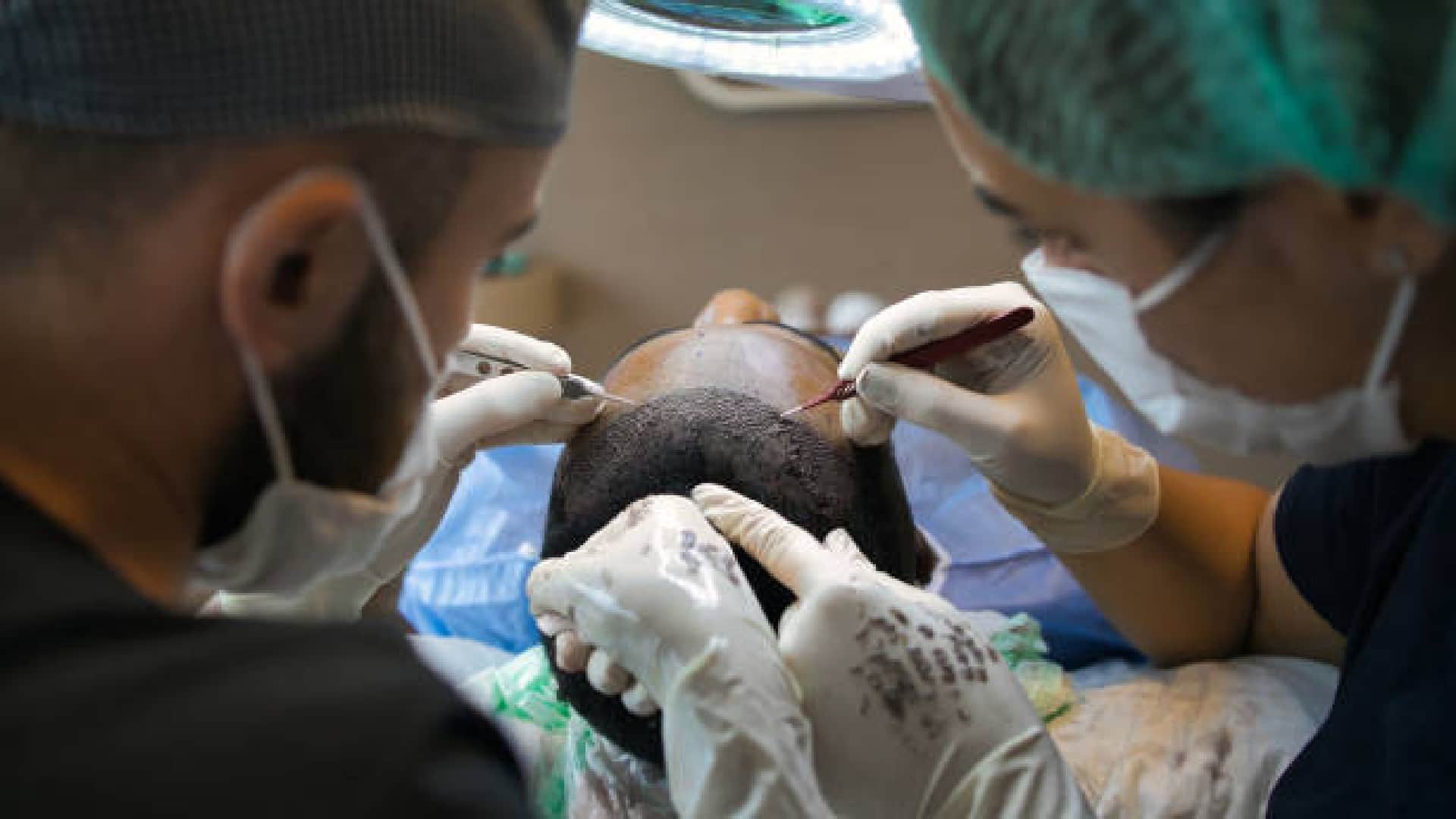 This Country Gives Best Hair Transplant Offers Affordable-Treatment They Receive From Airport News in Hindi