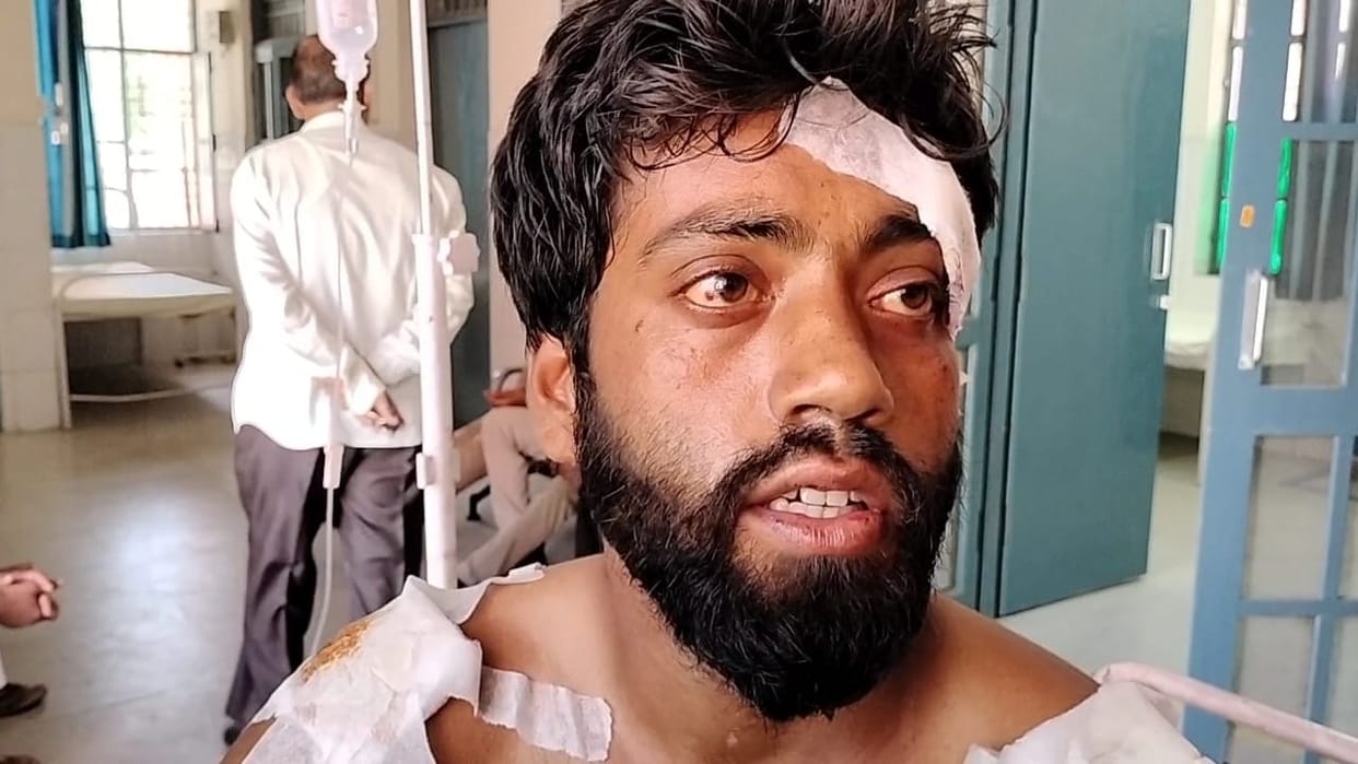 The lover's partner was beaten up hostage, the police took him to the hospital