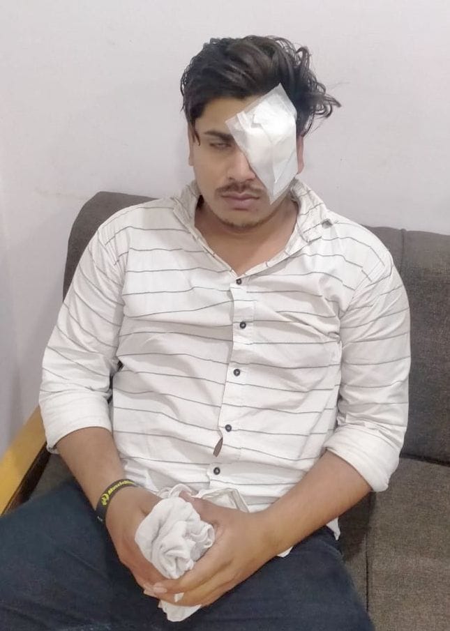 The young man lost the sight of one eye, the DCP handed over the investigation to the SCP