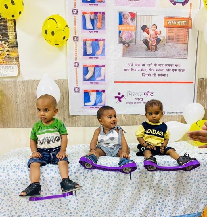 Get free treatment for club foot disease, Kurukshetra