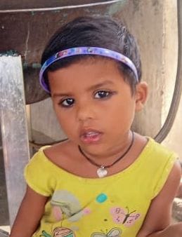 hardoi news,Innocent one fell in hot milk pan, one died
