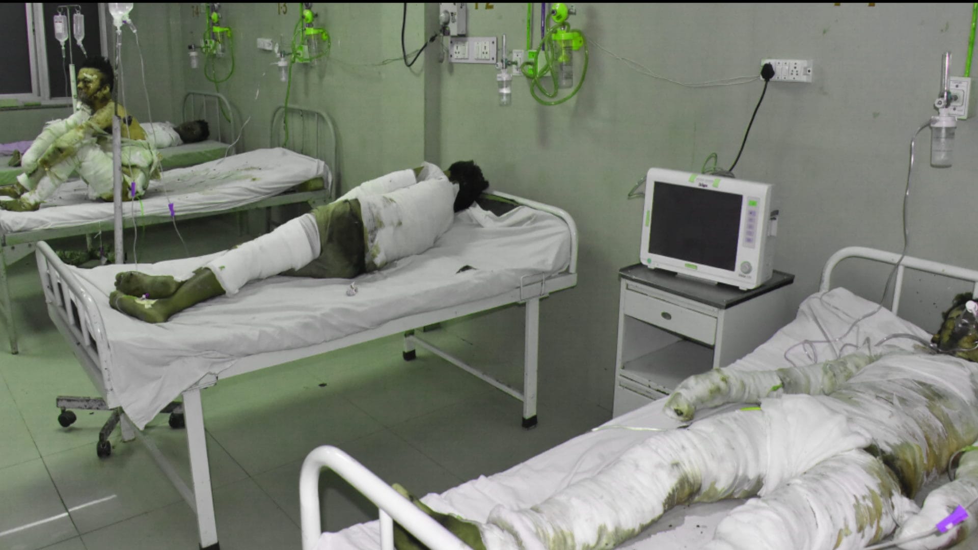 Hapur Explosion in Factory: Scorched People admitted to the Meerut medical emergency narrated the incident