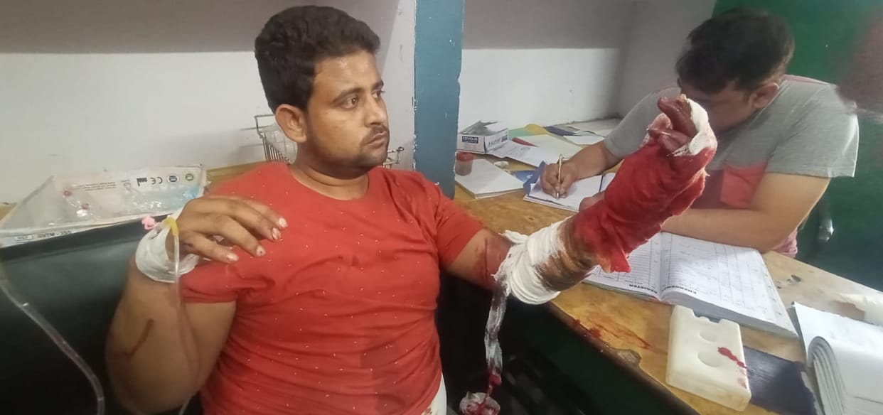 Knife went to the market in meat shopkeepers with three hundred rupees, four injured