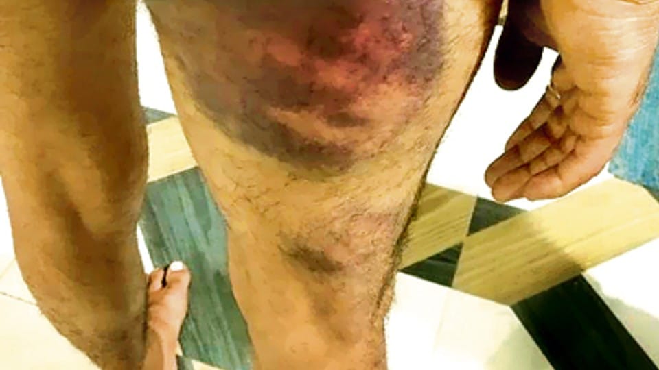 Indore Police: Student brutally beaten up in TI's cabin at Vijay Nagar police station, accused of taking money, TI denies allegations