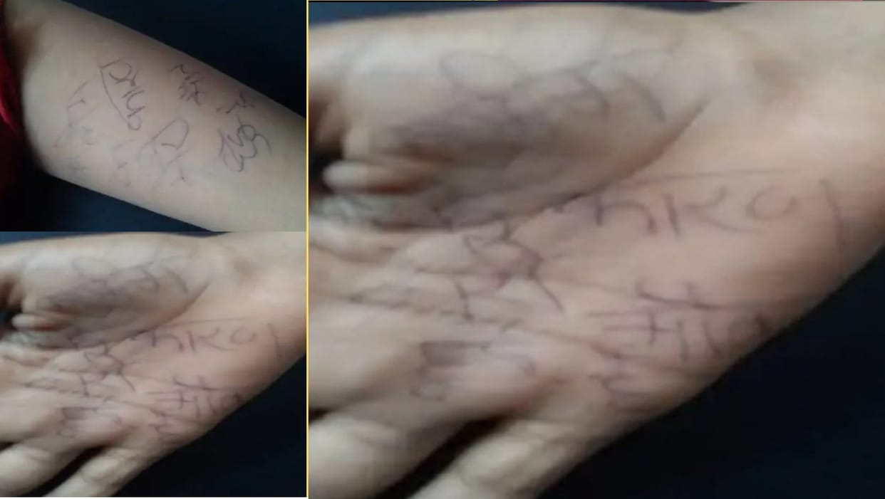 Rape victim of Prayagraj Kaushambi dies victim wrote about crime on her hand