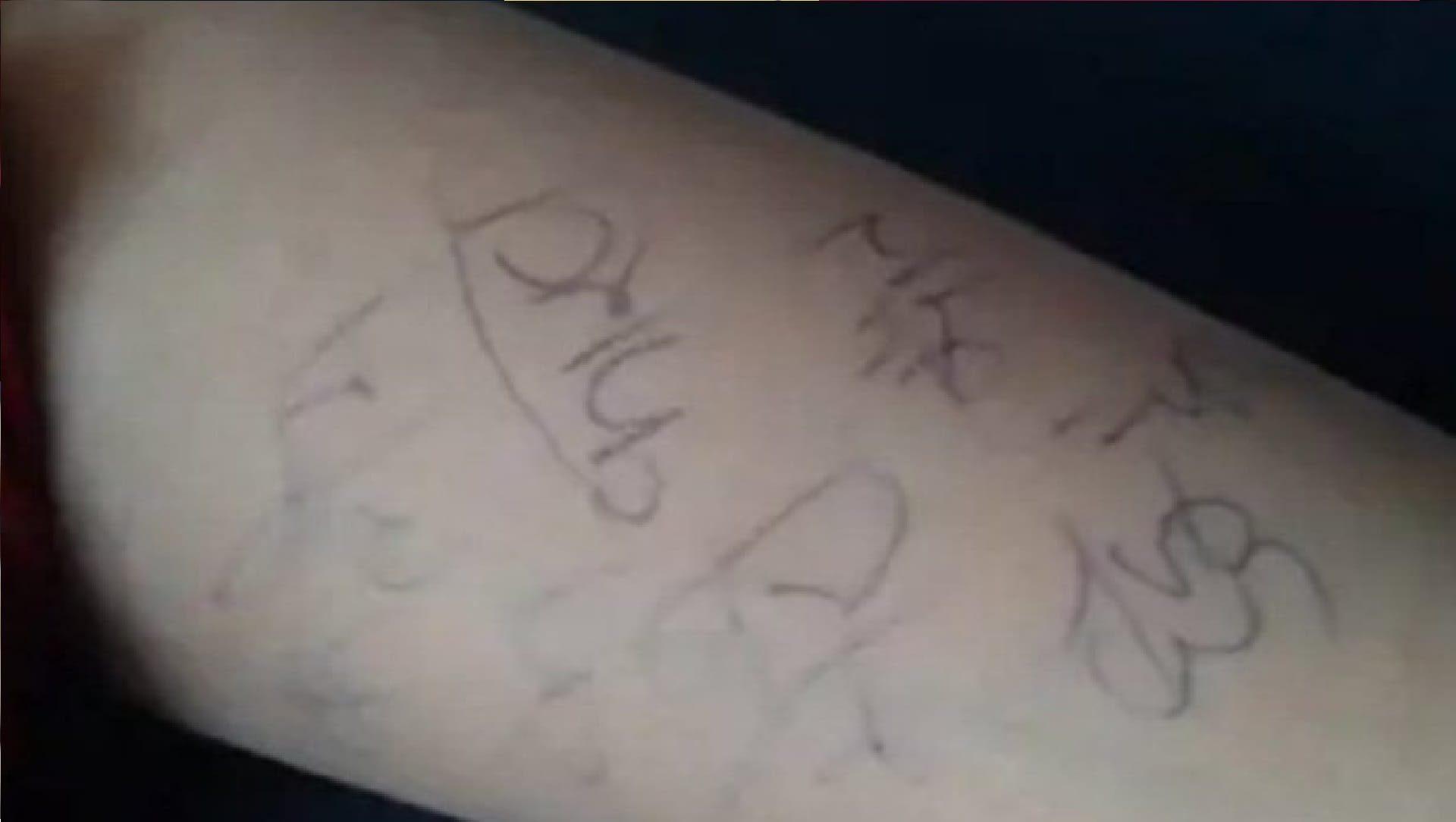 Rape victim of Prayagraj Kaushambi dies victim wrote about crime on her hand