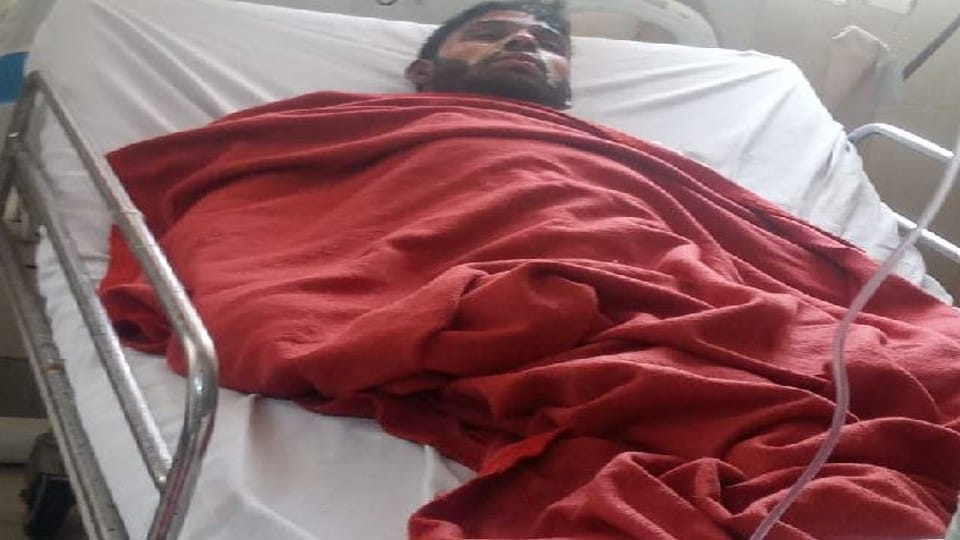 Father set fire the room after locked son family in agra