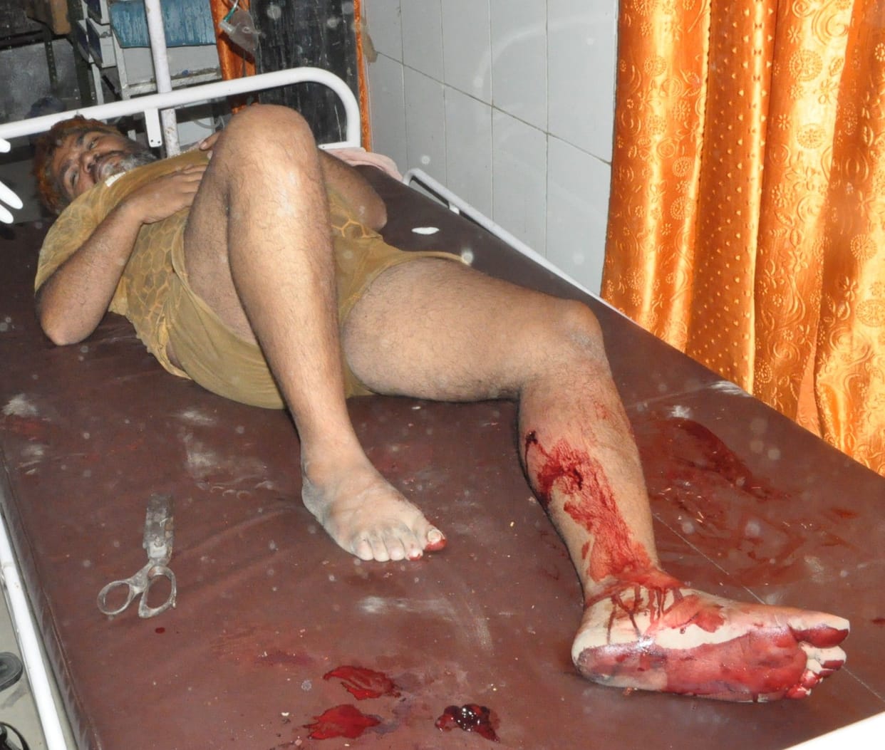 Hathras: Two cattle smugglers caught in an encounter, both injured due to bullet injuries