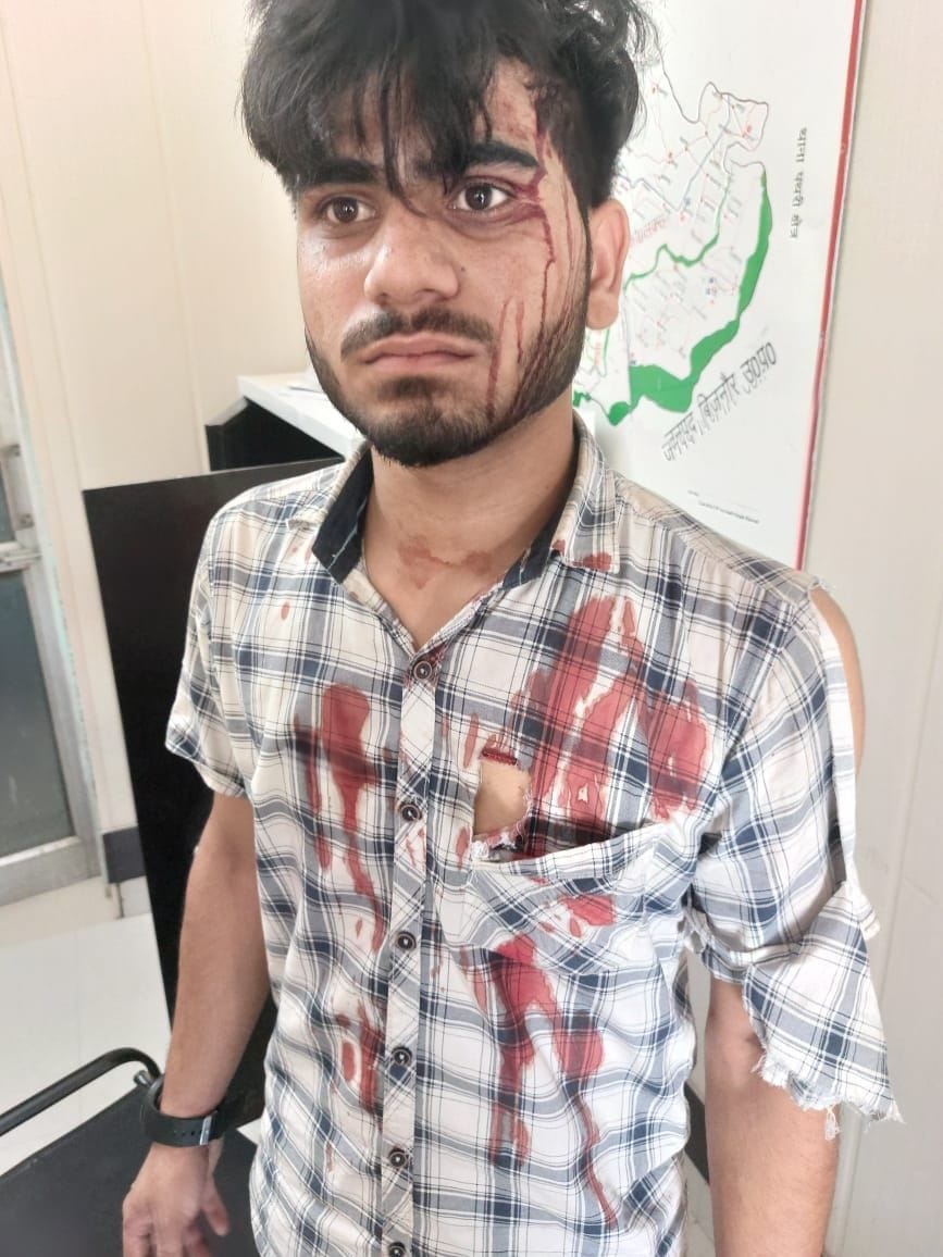 To trap the neighbor, a young man reached the police station by applying the blood of a chicken