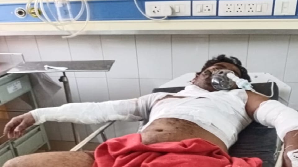 A worker injured in furnace explosion in Sahibabad Ghaziabad