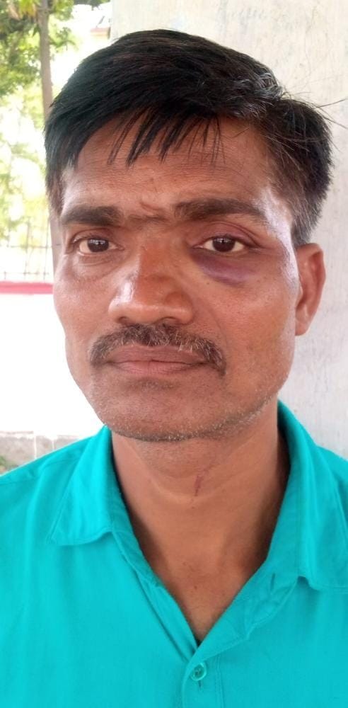 Grocery shopkeeper was robbed by beating him in broad daylight