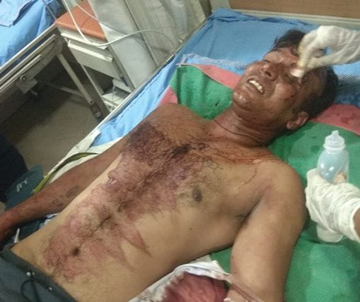 One accused arrested for assaulting a couple by entering the house