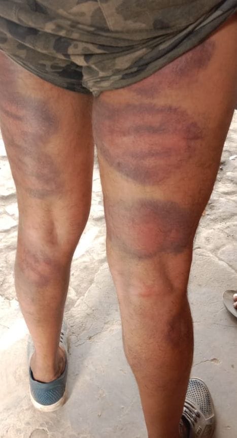 Police personnel beat the truck driver hostage for not paying bribe, snatched money