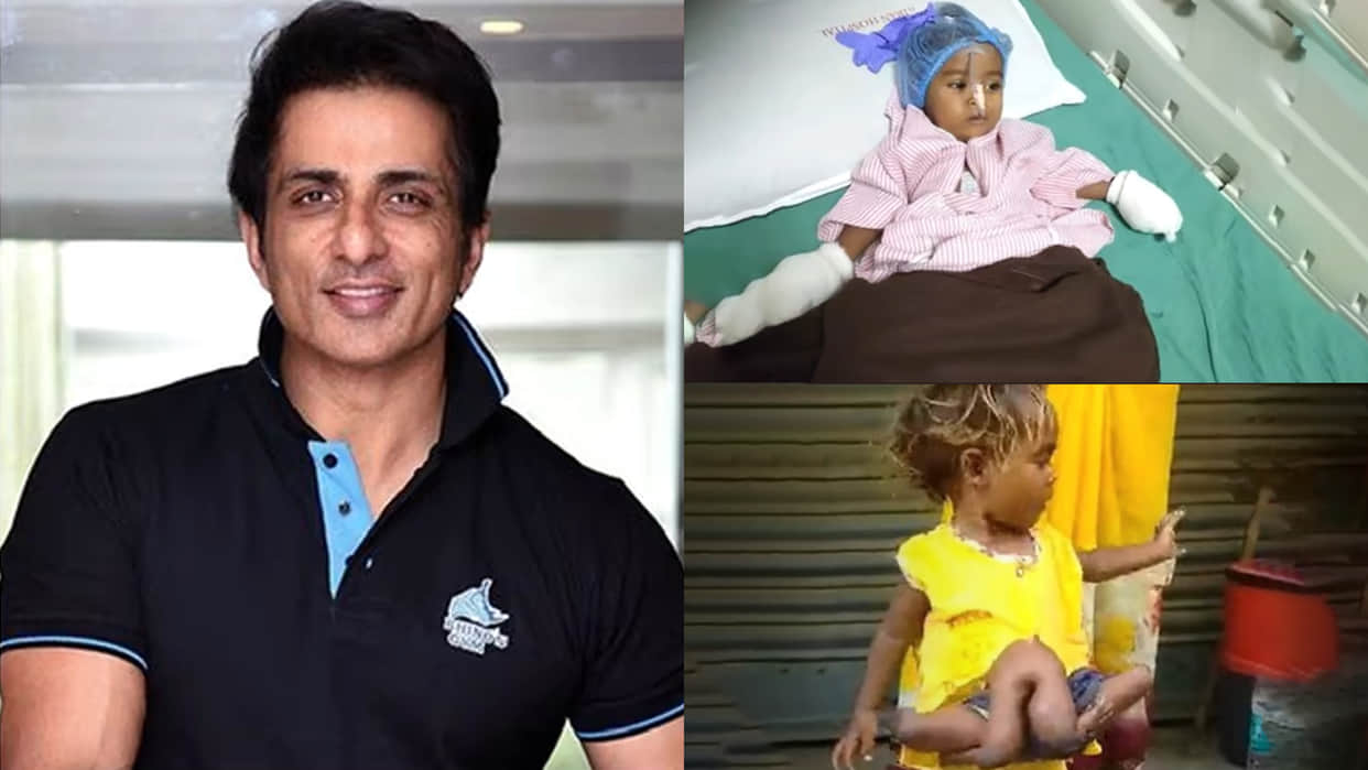 Actor Sonu Sood Helps Little Bihar Girl Who Was Born With Four Legs Four Arms News in Hindi