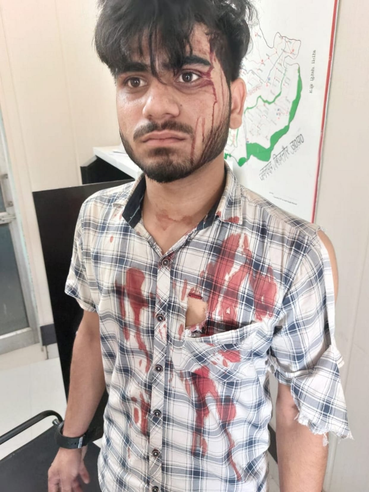 To trap neighbor young man reached police station by applying blood of chicken on body