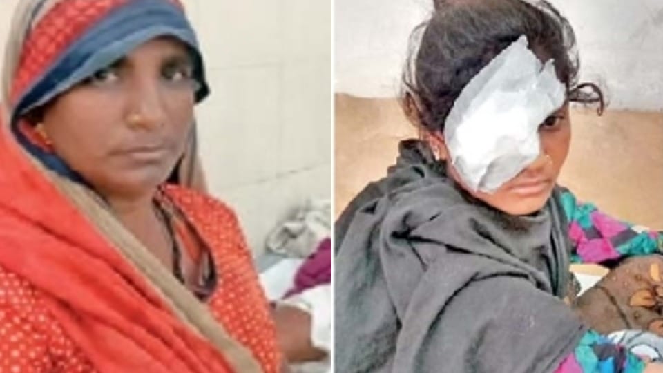 Grandmother saves granddaughter from leopard in Dhar of Madhya Pradesh