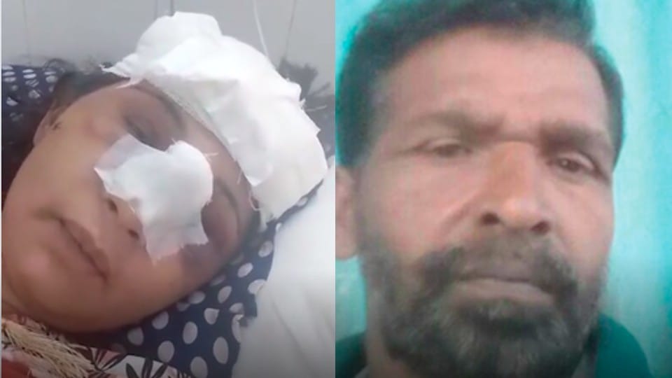 Madhya Pradesh: Husband hits head with hammer, tries to kill himself by strangulation, daughter says - father should be jailed