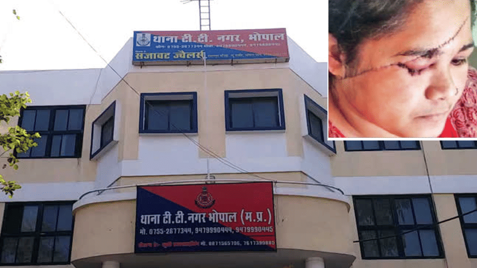 Bhopal: CM calls Bhopal commissioner on the incident of miscreants killing a woman, Shivraj will go to meet the woman