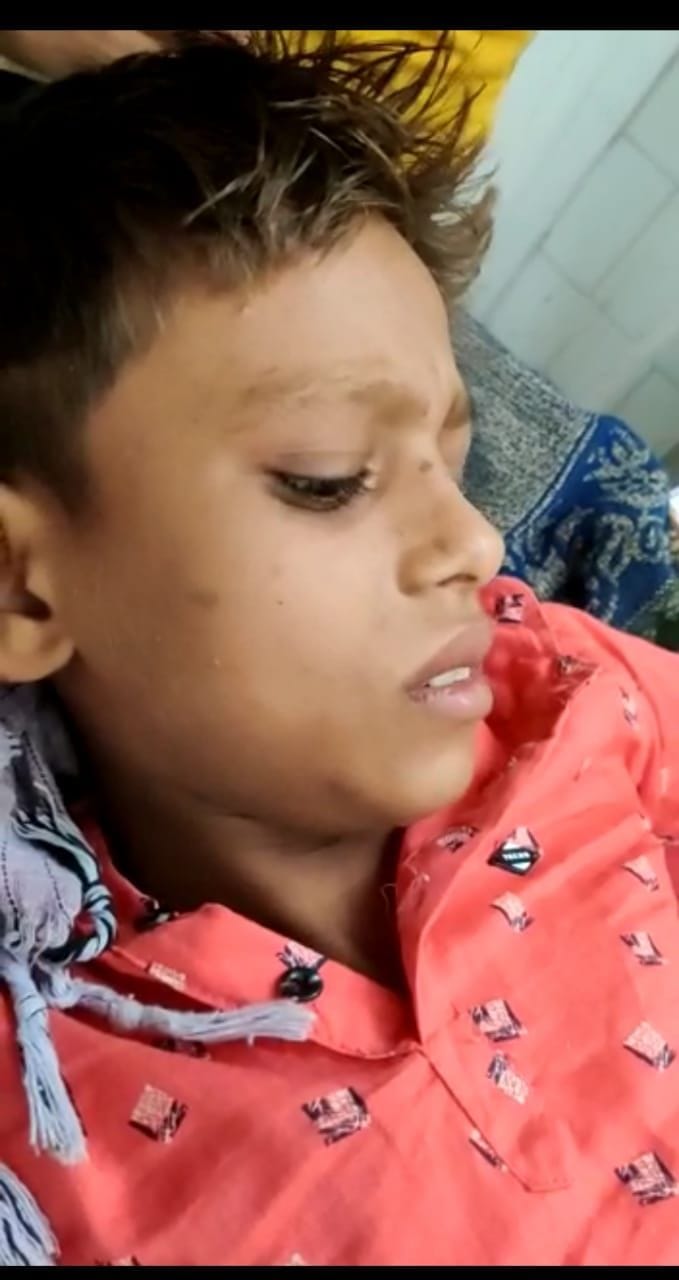 teenage boy injured in harsh firing
