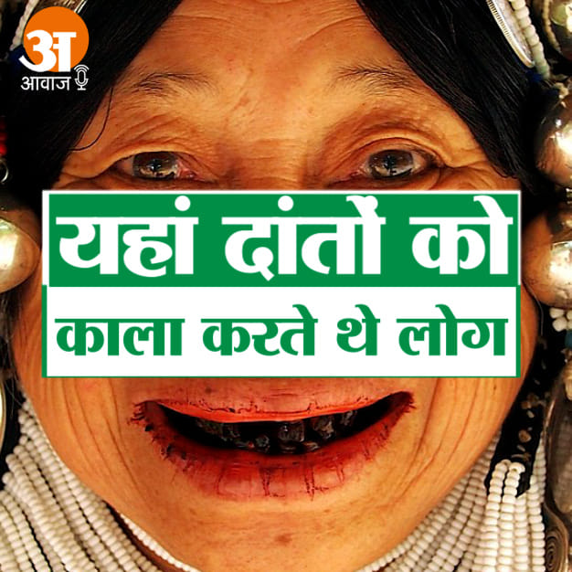 strange belief in teeth whitening