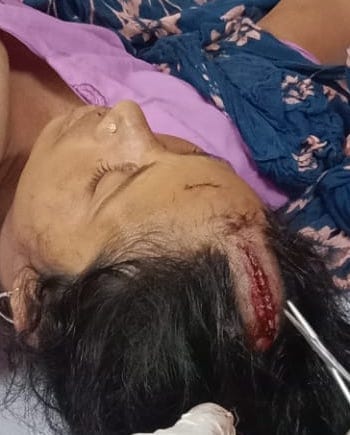 Attacked by entering the house on protest against molestation, seven injured
