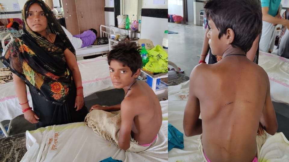 Chhatarpur News: The child tore the election poster, beat him with a bar, admitted to the district hospital