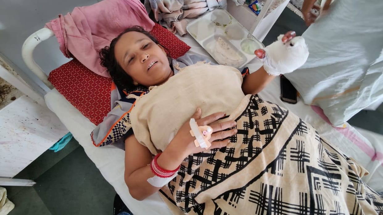 Chhatarpur: Woman's hand claw blown off in firecracker explosion, three fingers missing