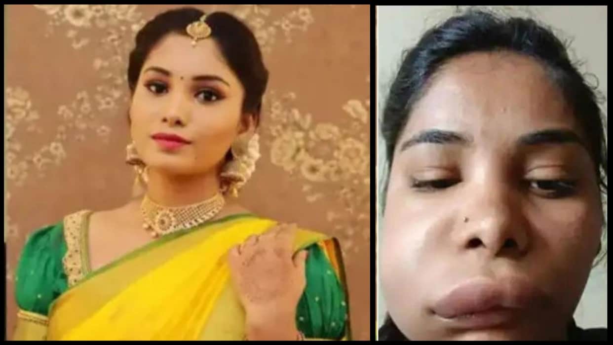 Kannada actress Swathi Sathish botched root canal surgery goes wrong shocking photos go viral