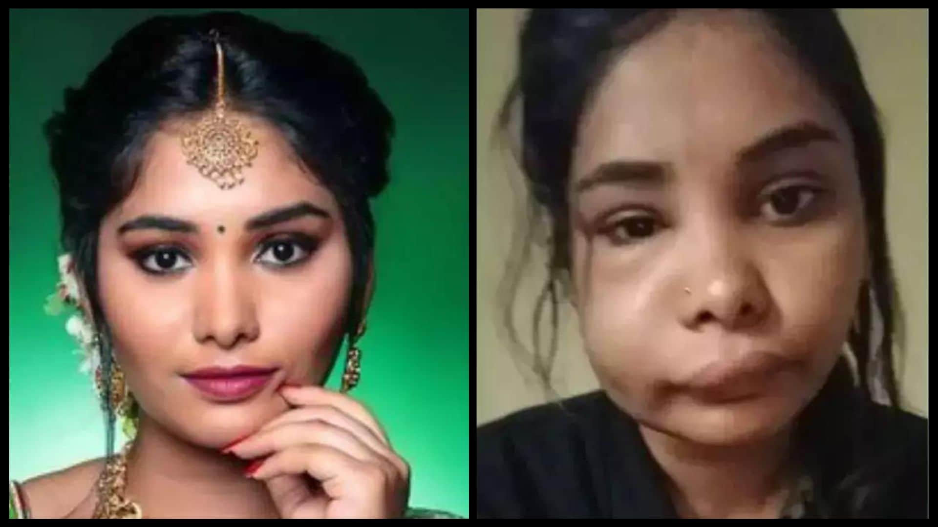 Kannada actress Swathi Sathish botched root canal surgery goes wrong shocking photos go viral