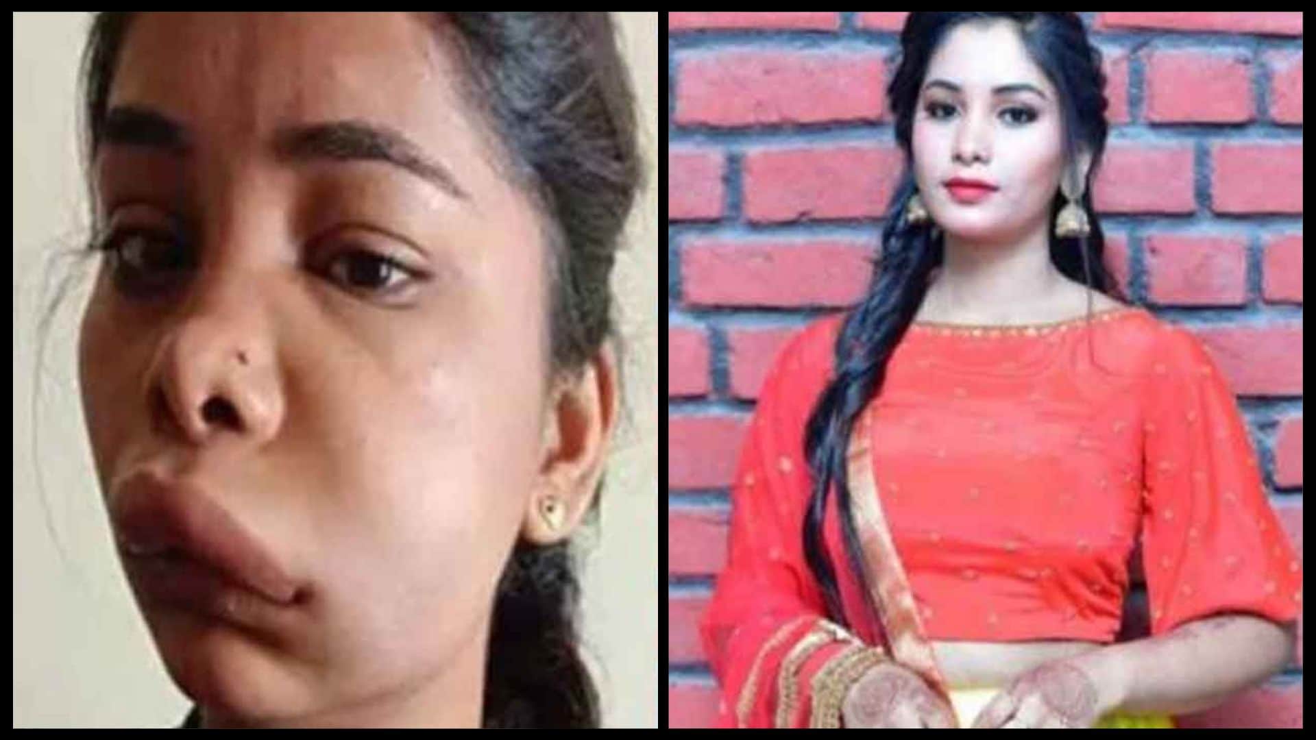 Kannada actress Swathi Sathish botched root canal surgery goes wrong shocking photos go viral