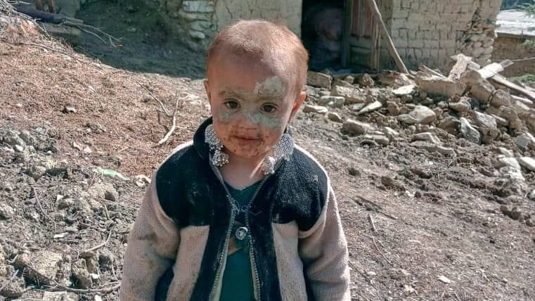 picture of girl who survived the earthquake is going viral