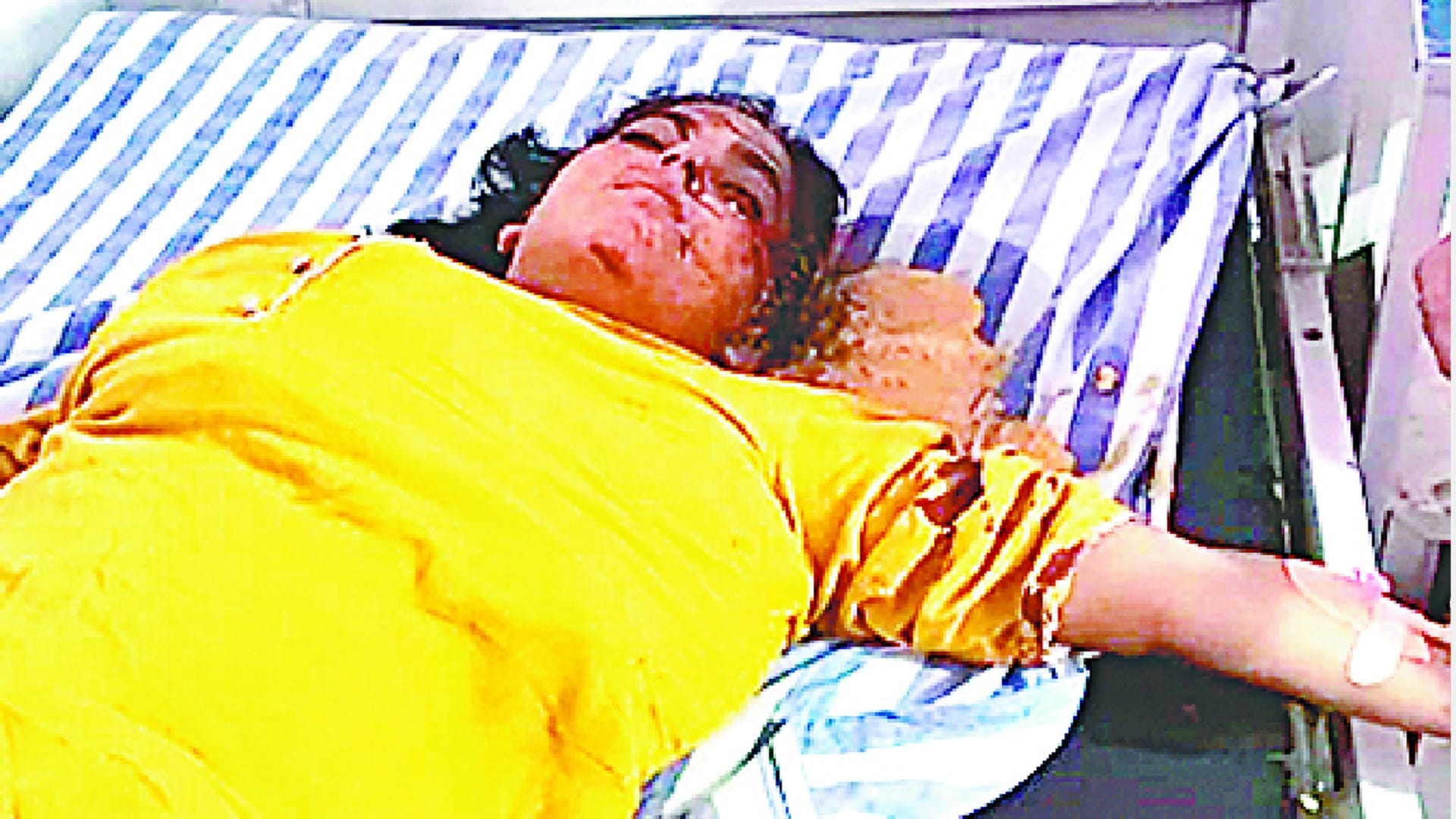 SUV car overturned after tire burst on Khirwa Road  in Meerut, injuring 13 people including children