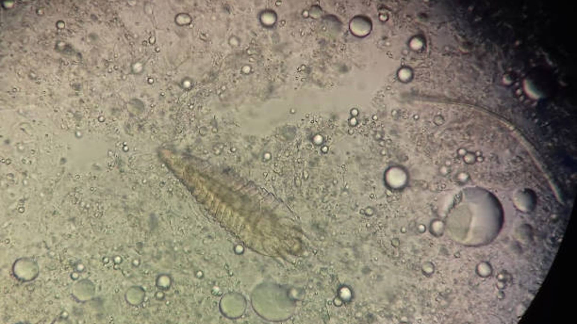 Tiny Mites: skin mites makes physical relation on human face daily while sleeping, claims after research