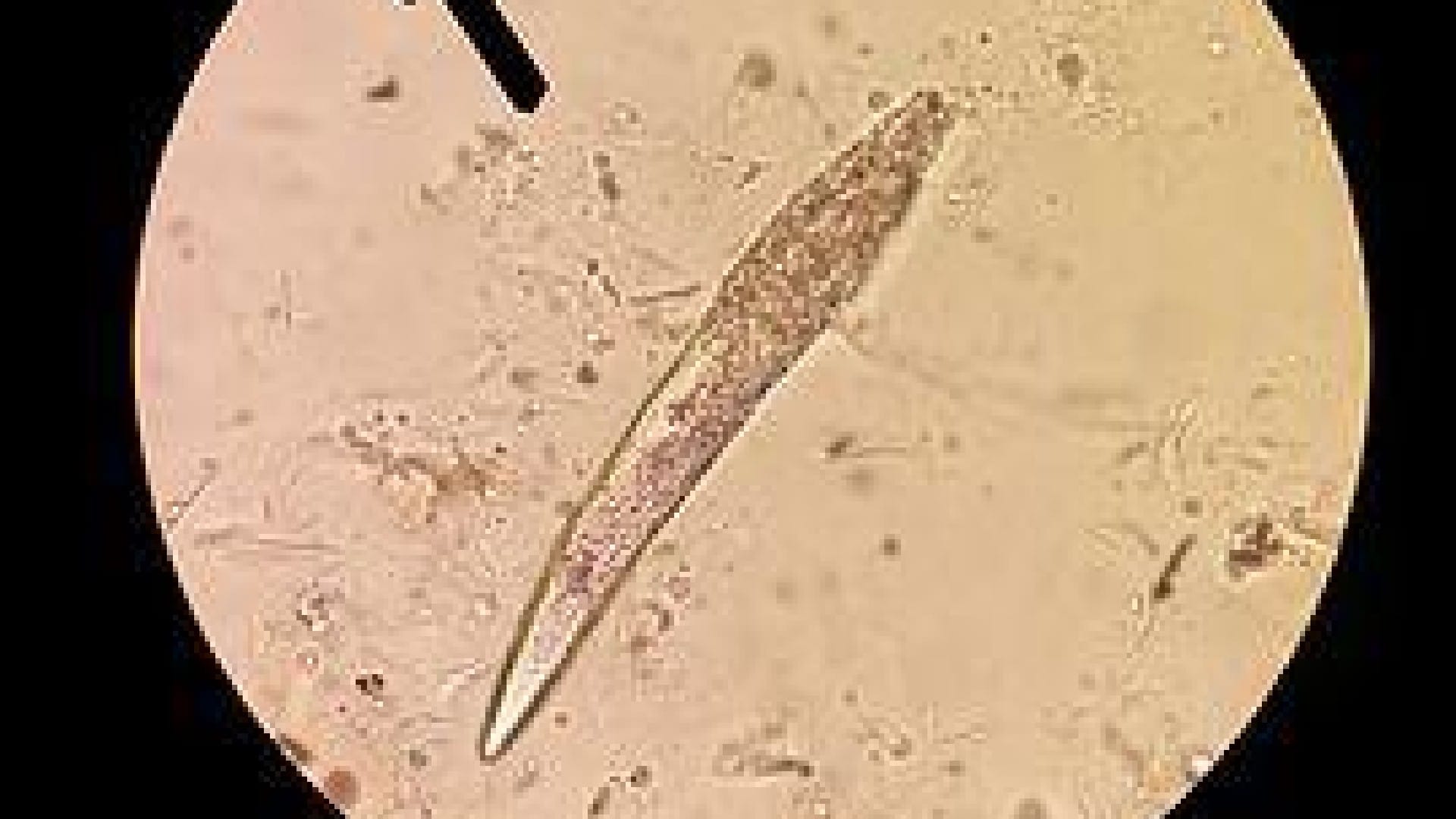 Tiny Mites: skin mites makes physical relation on human face daily while sleeping, claims after research