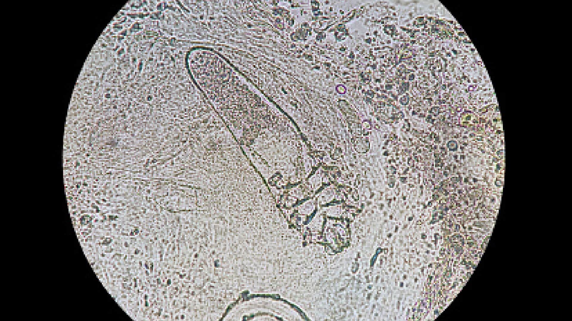 Tiny Mites: skin mites makes physical relation on human face daily while sleeping, claims after research