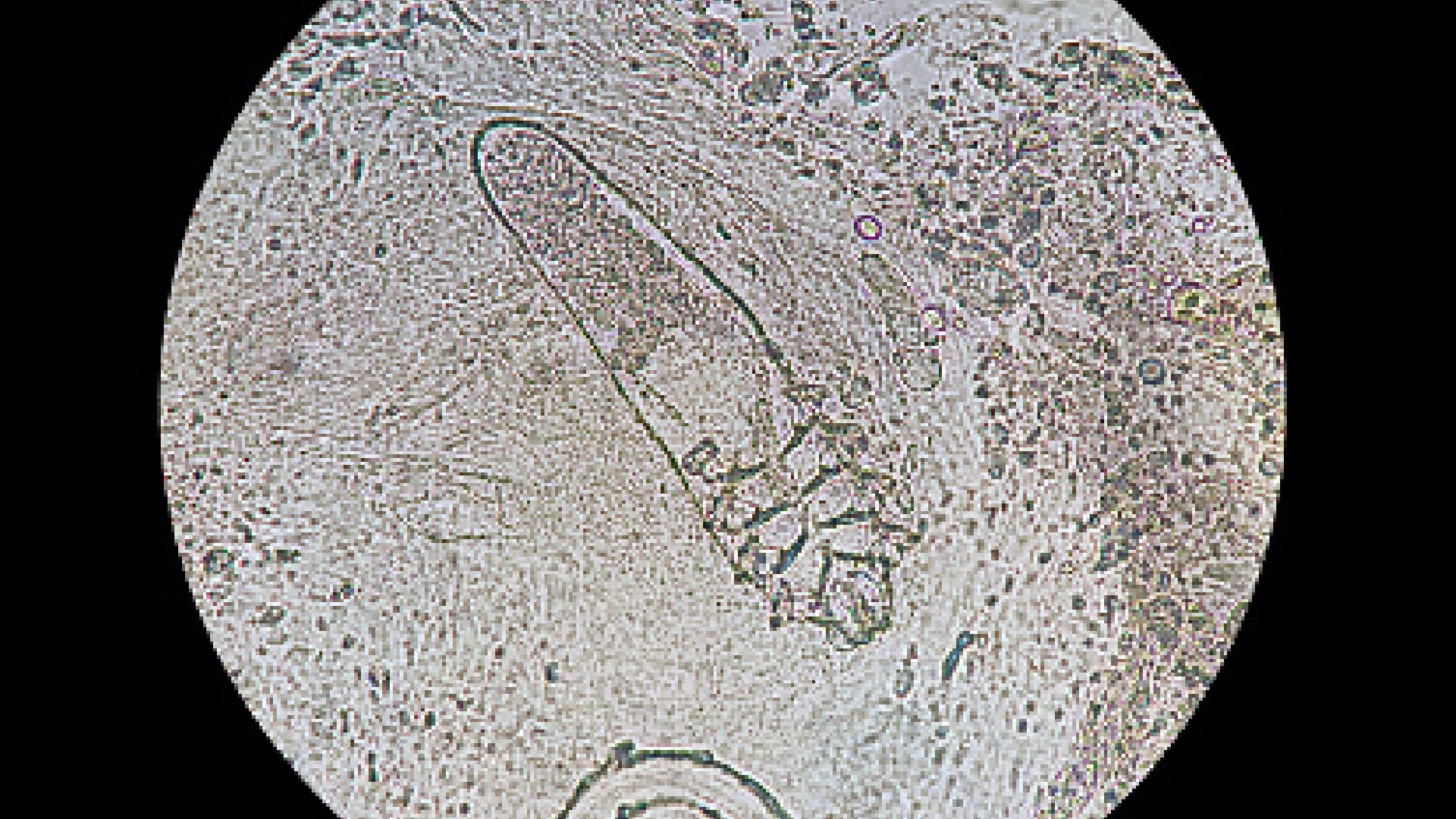 Tiny Mites: skin mites makes physical relation on human face daily while sleeping, claims after research