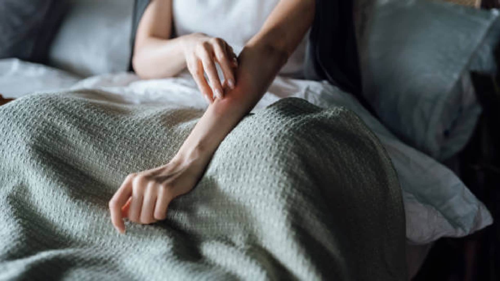 Tiny Mites: skin mites makes physical relation on human face daily while sleeping, claims after research