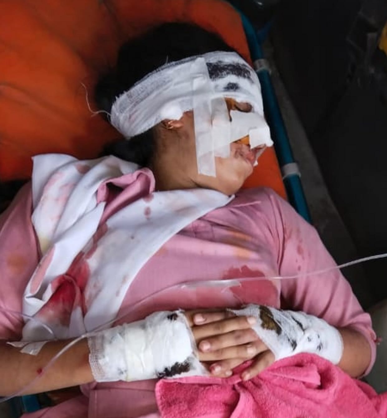 The bus did not brake with the driver wearing slippers, the girl was hit