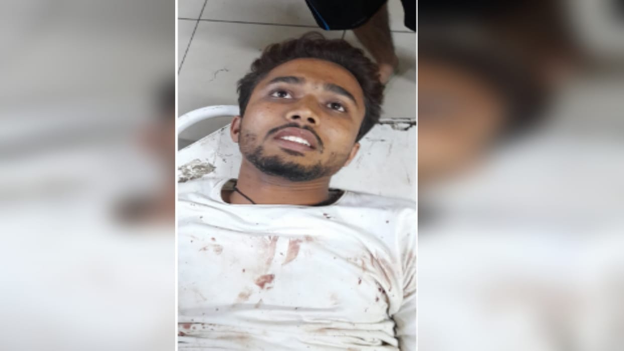 Criminal fearless: Two brothers were fired upon in Lisadigate, Meerut, police arrested two