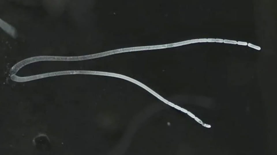 Largest bacterium which is visible to the naked eye discovered