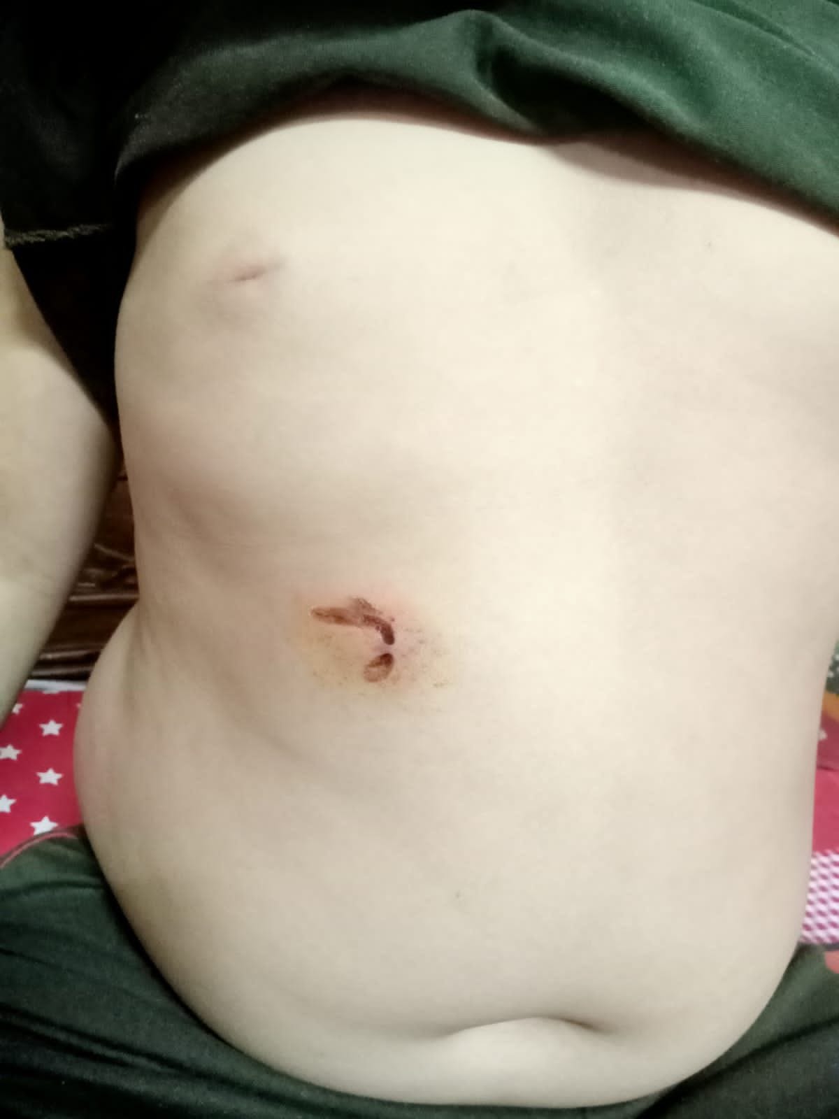 Neighbor's pitbull attacked mother and son