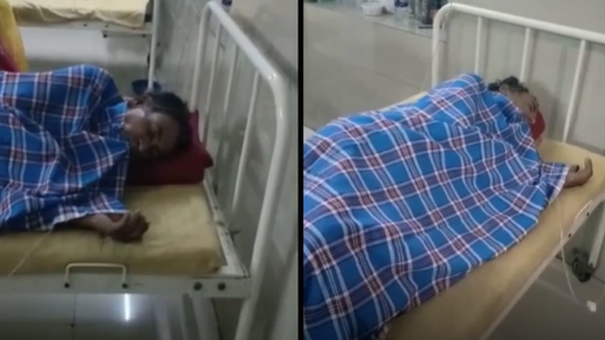 Son set father on fire in Pali When he came to intervene in the quarrel of the sons