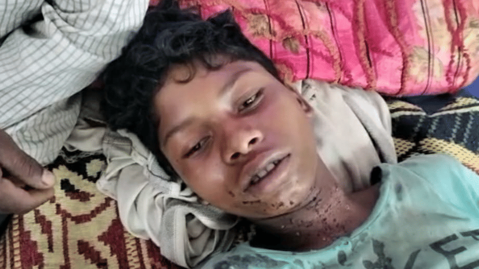 Chhindwara News: Six-year-old innocent was playing with old battery, serious injury in hand due to blast