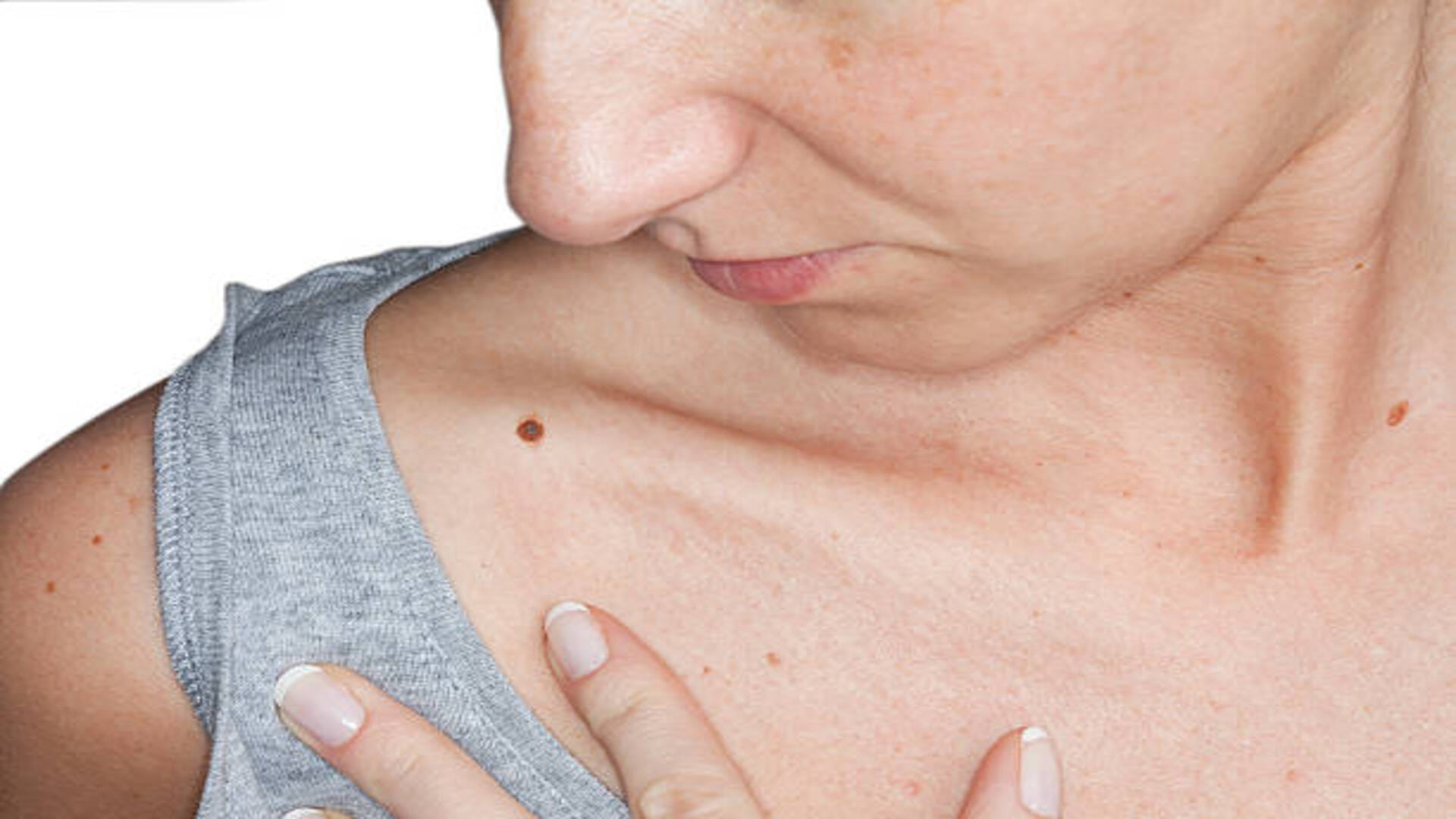 lucky moles on female body In Hindi according to Samudrik Shastra