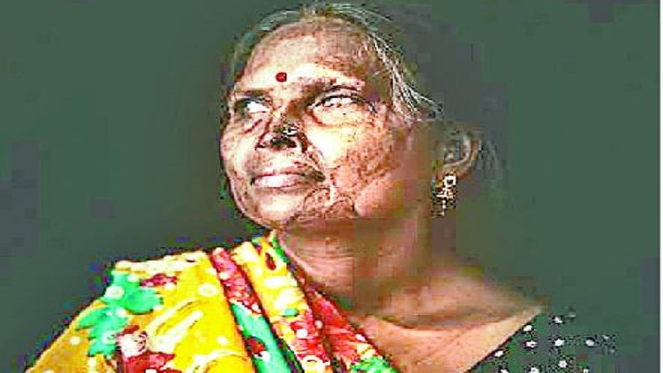 Agra Acid Attack Survivor Mother-daughter Story Screened At Melbourne Film Festival