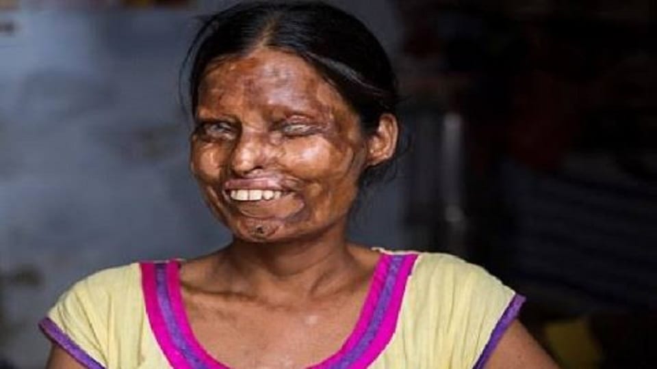 Agra Acid Attack Survivor Mother-daughter Story Screened At Melbourne Film Festival